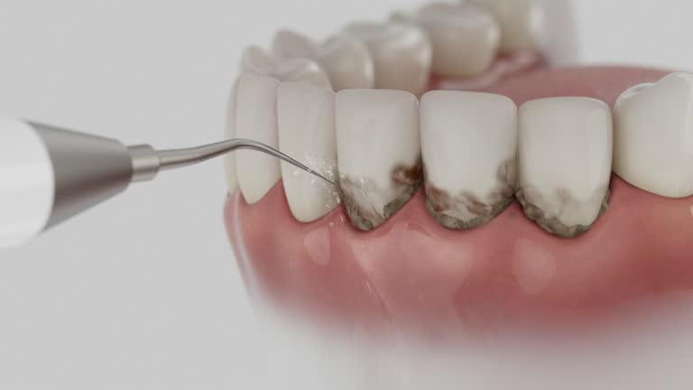 Reliable Dental contractor in Montalvin Manor, CA by Dentist Open Now